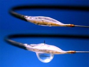 Bullfrog catheter tracking (top) and inflated for infusion (botton) with needle out.