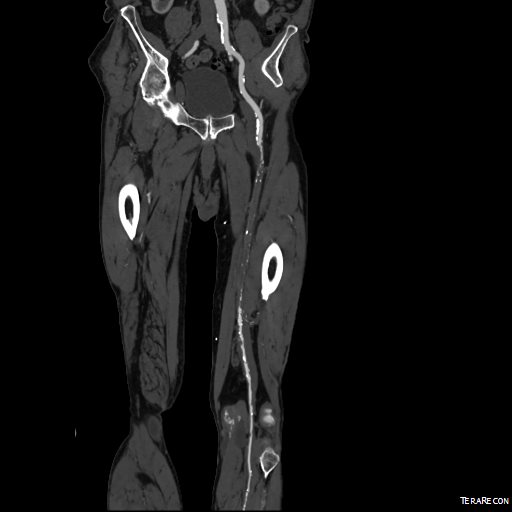 00016287326_20150730_6