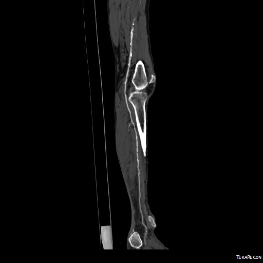 00016287326_20150730_7