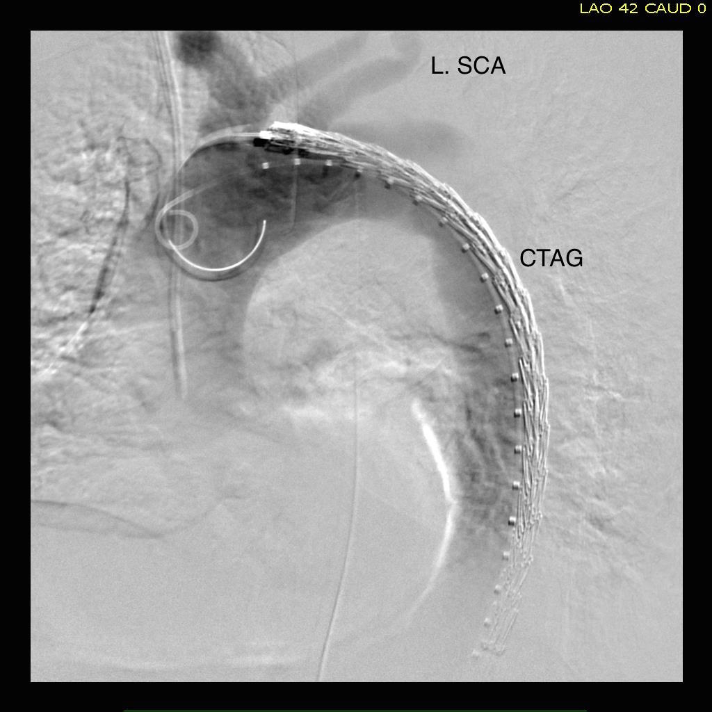 Before deploying CTAG