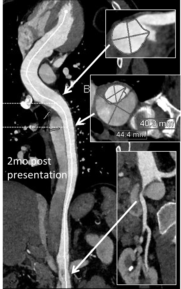 CTA at 2mo post presentation