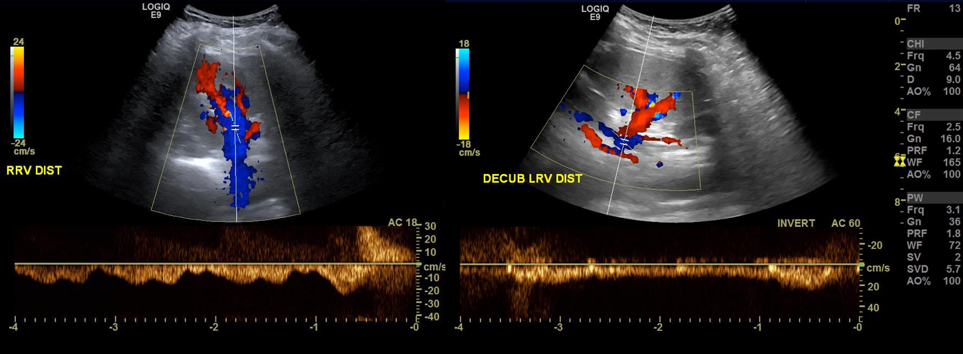 spectral kidneys