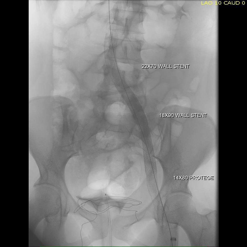 completion fluoro.jpg