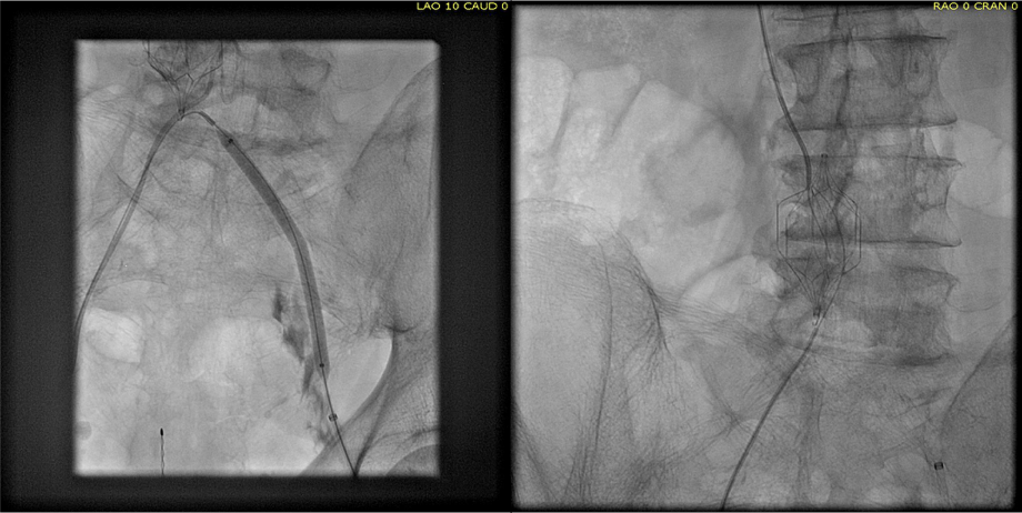 intervention fig 2.png