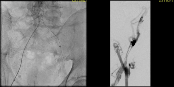 intervention fig 3.png