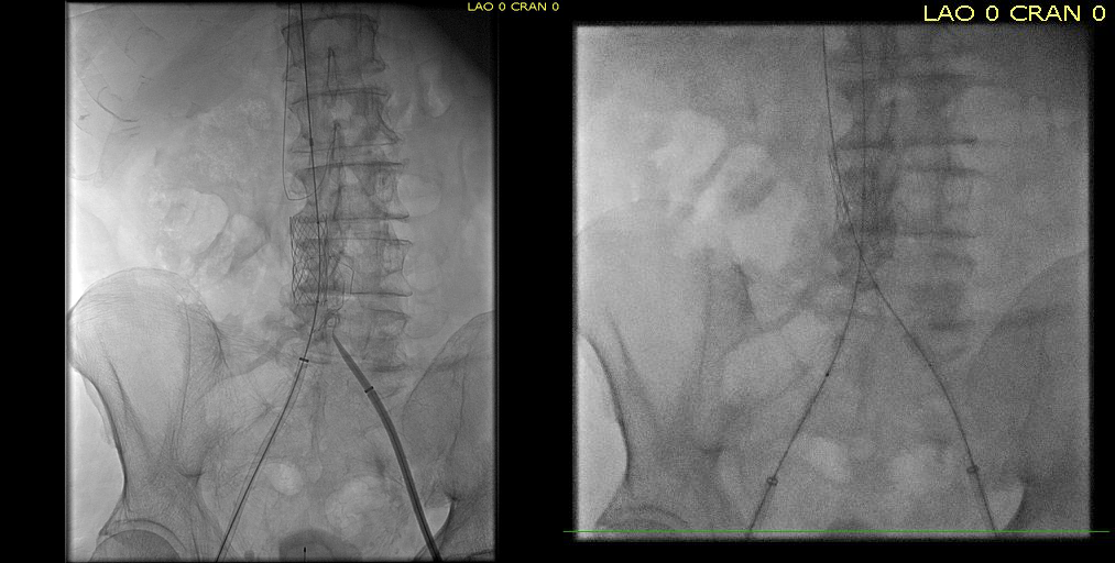 intervention fig 5.png