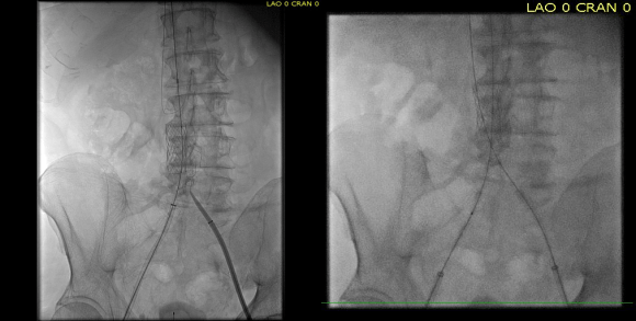 intervention fig 5.png