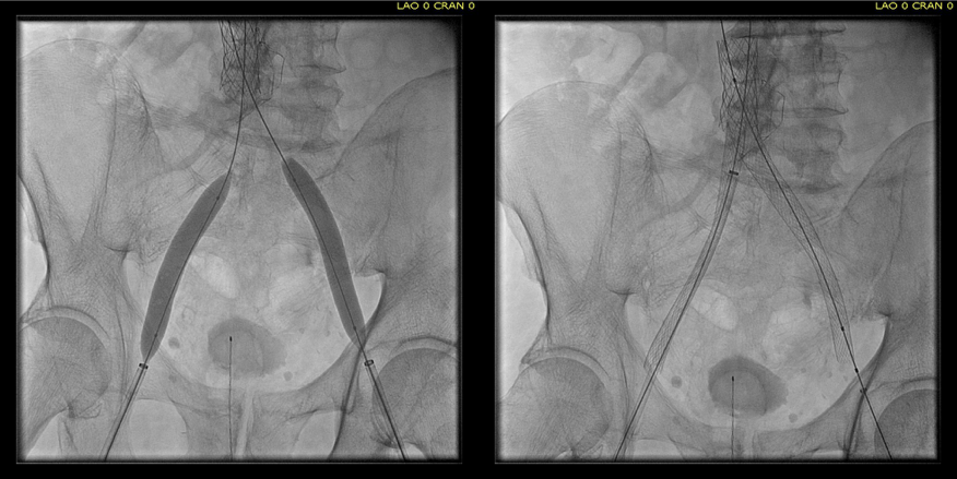 intervention fig 6.png