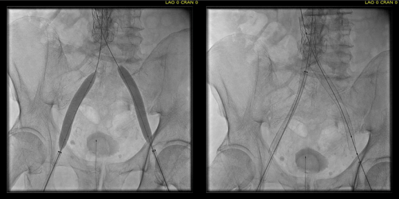 intervention fig 6.png