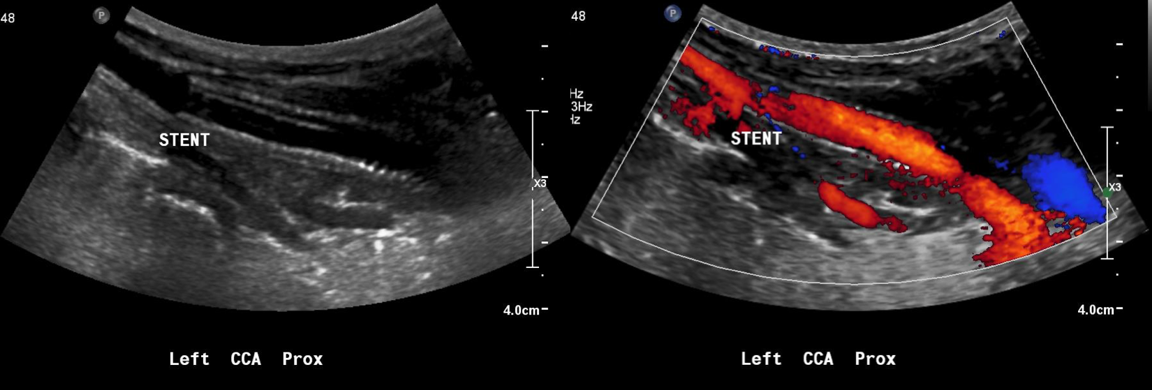 7 months post op.png