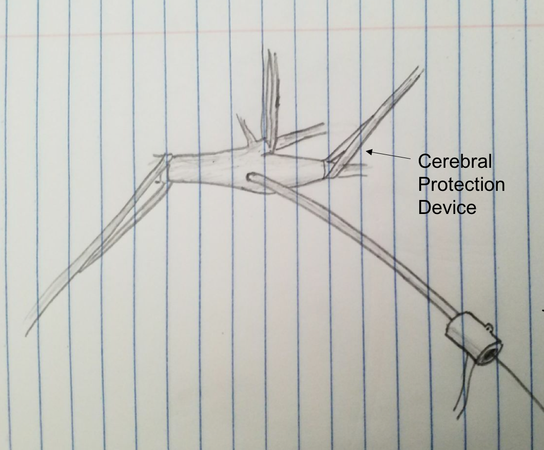 carotid control